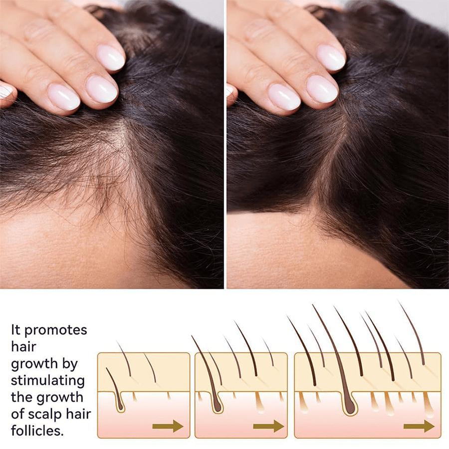 FEG Plus Hair Grow Spray
