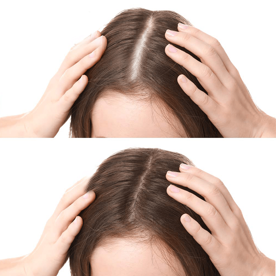 FEG Plus Hair Grow Spray